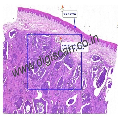 Oral Pathology Digital Slides Set (MDS & PG Students)